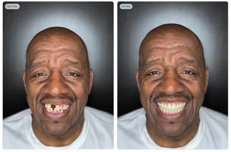Man’s original smile beside his SmileInspo-generated smile simulation